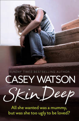 Casey Watson - Skin Deep: All she wanted was a mummy, but was she too ugly to be loved? - 9780007595099 - V9780007595099