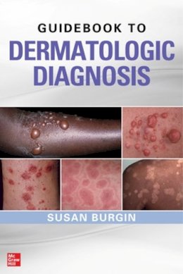 Susan Burgin - Guidebook to Dermatologic Diagnosis - 9780071738750 - V9780071738750