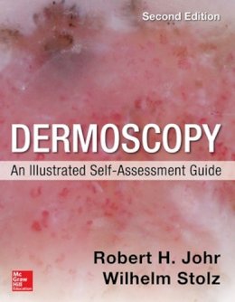 Robert Johr - Dermoscopy: An Illustrated Self-Assessment Guide, 2/e - 9780071834346 - V9780071834346