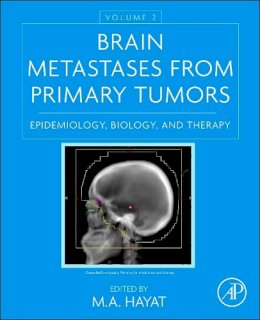 M. Hayat - Brain Metastases from Primary Tumors, Volume 2: Epidemiology, Biology, and Therapy - 9780128014196 - V9780128014196