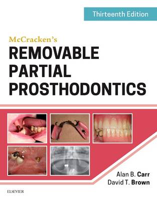 Alan B. Carr - McCracken´s Removable Partial Prosthodontics - 9780323339902 - V9780323339902