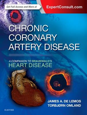 James De Lemos - Chronic Coronary Artery Disease: A Companion to Braunwald´s Heart Disease - 9780323428804 - V9780323428804