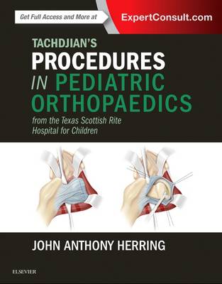 John A. Herring - Tachdjian´s Procedures in Pediatric Orthopaedics: From the Texas Scottish Rite Hospital for Children - 9780323448086 - V9780323448086