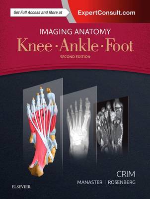 Julia R. Crim - Imaging Anatomy: Knee, Ankle, Foot - 9780323477802 - V9780323477802