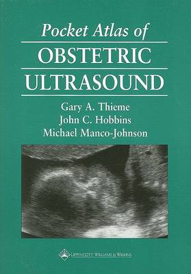 G.a. Thieme - Pocket Atlas of Obstetric Ultrasound - 9780397516230 - V9780397516230