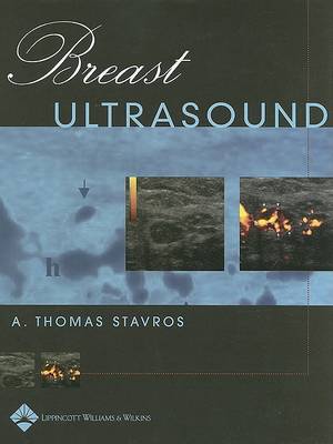 A.thomas Stavros - Breast Ultrasound - 9780397516247 - V9780397516247