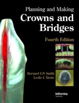 Bernard G. N. Smith - Planning and Making Crowns and Bridges - 9780415398503 - V9780415398503