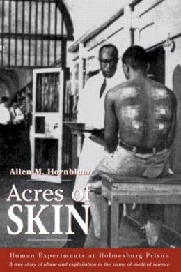 Allen M. Hornblum - Acres of Skin: Human Experiments at Holmesburg Prison - 9780415923361 - V9780415923361