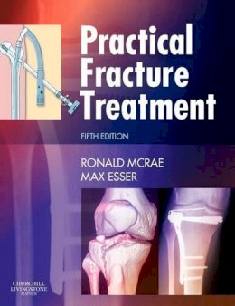 Ronald Mcrae - Practical Fracture Treatment - 9780443068768 - V9780443068768