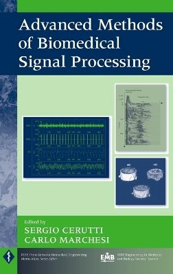 Sergio Cerutti - Advanced Methods of Biomedical Signal Processing - 9780470422144 - V9780470422144