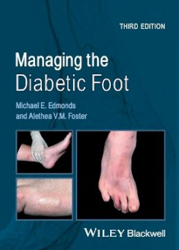 Michael E. Edmonds - Managing the Diabetic Foot - 9780470655054 - V9780470655054