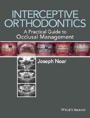 Joseph Noar - Interceptive Orthodontics: A Practical Guide to Occlusal Management - 9780470656211 - V9780470656211