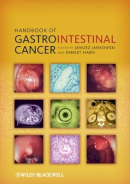 Janusz Jankowski - Handbook of Gastrointestinal Cancer - 9780470656242 - V9780470656242