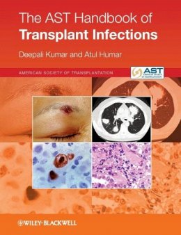 Deepali Kumar - The AST Handbook of Transplant Infections - 9780470658277 - V9780470658277