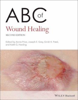 Unknown - ABC of Wound Healing - 9780470658970 - V9780470658970