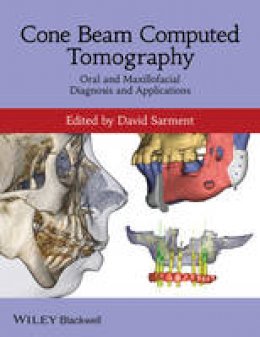 David Sarment - Cone Beam Computed Tomography - 9780470961407 - V9780470961407