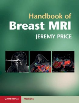 Jeremy Price - Handbook of Breast MRI - 9780521139663 - V9780521139663