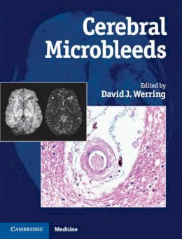 David Werring - Cerebral Microbleeds: Pathophysiology to Clinical Practice - 9780521198455 - V9780521198455