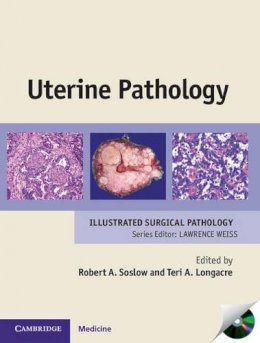 Robert A. Soslow - Uterine Pathology - 9780521509800 - V9780521509800