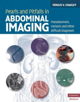 Fergus V. Coakley - Pearls and Pitfalls in Abdominal Imaging: Pseudotumors, Variants and Other Difficult Diagnoses - 9780521513777 - V9780521513777