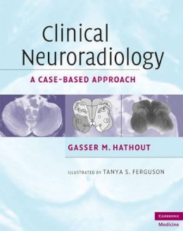 Gasser M. Hathout - Clinical Neuroradiology: A Case-Based Approach - 9780521600545 - V9780521600545
