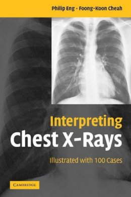 Philip Eng - Interpreting Chest X-Rays: Illustrated with 100 Cases - 9780521607322 - V9780521607322