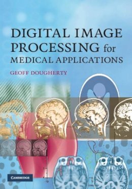 Geoff Dougherty - Digital Image Processing for Medical Applications - 9780521860857 - V9780521860857