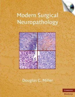 Douglas C. Miller - Modern Surgical Neuropathology with CD-ROM - 9780521869324 - V9780521869324