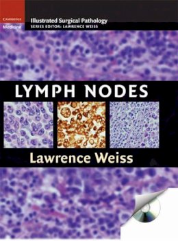 Lawrence M. Weiss - Lymph Nodes - 9780521871617 - V9780521871617