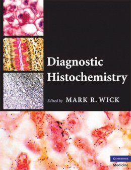 Mark R. Wick (Ed.) - Diagnostic Histochemistry - 9780521874106 - V9780521874106