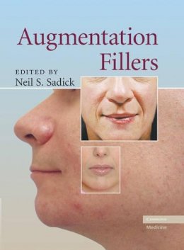 Neil S (Ed) Sadick - Augmentation Fillers - 9780521881128 - V9780521881128