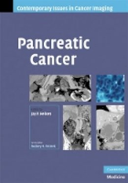 Jay Heiken (Ed.) - Pancreatic Cancer - 9780521886925 - V9780521886925
