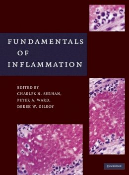 Peter(Ed)Et Al Ward - Fundamentals of Inflammation - 9780521887298 - V9780521887298