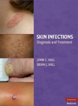 Brian J. Hall - Skin Infections - 9780521897297 - V9780521897297