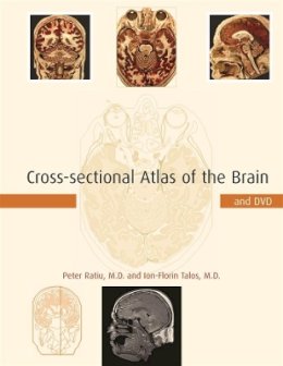 Peter Ratiu - Cross-Sectional Atlas of the Human Brain - 9780674019232 - V9780674019232