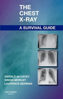 Gerald De Lacey - The Chest X-Ray, a Survival Guide - 9780702030468 - V9780702030468