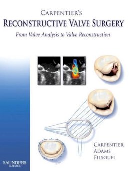 Alain Carpentier - Carpentier's Reconstructive Valve Surgery - 9780721691688 - V9780721691688