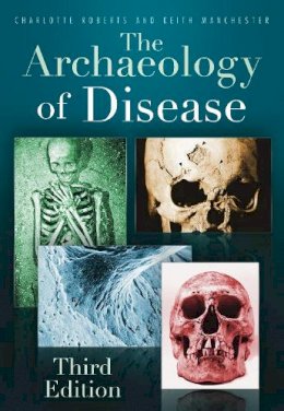 Charlotte Roberts - The Archaeology of Disease: Third Edition - 9780752457505 - V9780752457505