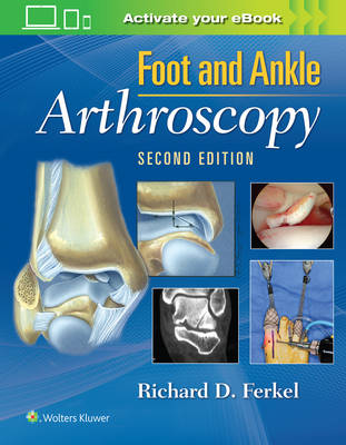 Richard D. Ferkel - Foot & Ankle Arthroscopy - 9780781783415 - V9780781783415