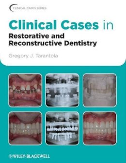 Gregory J. Tarantola - Clinical Cases in Restorative and Reconstructive Dentistry - 9780813815640 - V9780813815640