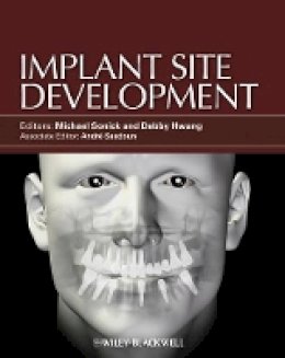 Michael Sonick - Implant Site Development - 9780813825120 - V9780813825120 Michael Sonick - Implant Site Development - 9780813825120 - V9780813825120