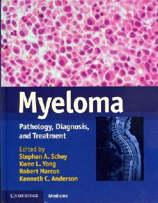Edited By Stephen A. - Myeloma: Pathology, Diagnosis, and Treatment - 9781107010574 - V9781107010574