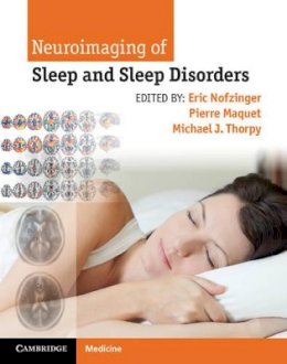 Eric Nofzinger - Neuroimaging of Sleep and Sleep Disorders - 9781107018631 - V9781107018631