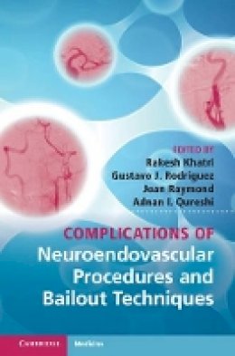 Rakesh Khatri (Ed.) - Complications of Neuroendovascular Procedures and Bailout Techniques - 9781107030022 - V9781107030022