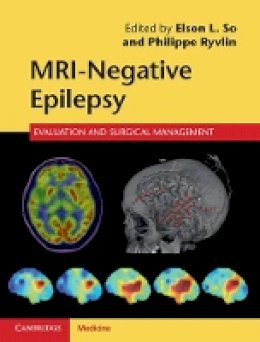 Edited By Elson L. S - MRI-Negative Epilepsy: Evaluation and Surgical Management - 9781107034235 - V9781107034235