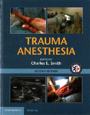 Charles Smith - Trauma Anesthesia - 9781107038264 - V9781107038264
