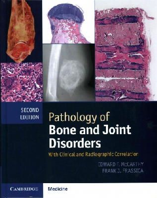Edward F. Mccarthy - Pathology of Bone and Joint Disorders Print and Online Bundle: With Clinical and Radiographic Correlation - 9781107041233 - V9781107041233