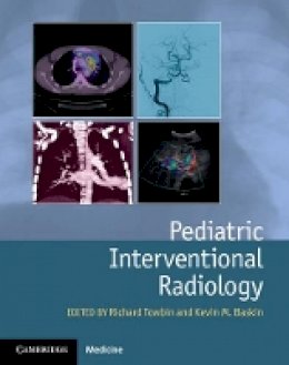 Richard Towbin - Pediatric Interventional Radiology - 9781107042629 - V9781107042629
