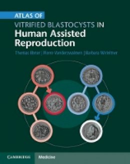 Thomas Ebner - Atlas of Vitrified Blastocysts in Human Assisted Reproduction - 9781107074095 - V9781107074095