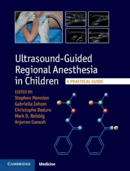 Stephen Mannion - Ultrasound-Guided Regional Anesthesia in Children: A Practical Guide - 9781107098770 - V9781107098770